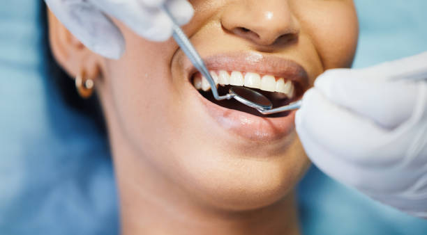 Best Emergency Tooth Extraction in Harrison, TN